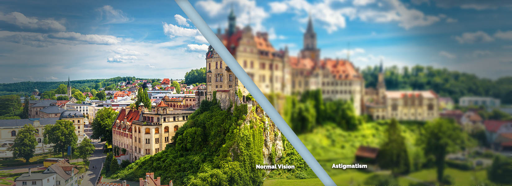 Astigmatism Treatment in Aurora