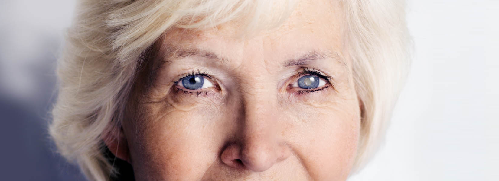 Cataract Surgery in Aurora